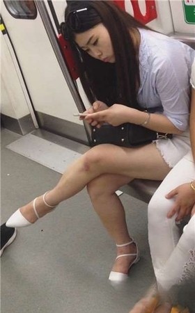 地铁上极品美腿美女，你膝盖上的伤还好吧。