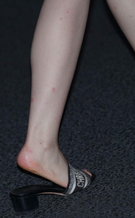 250817-6 170p